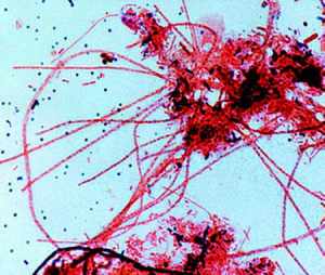 Thiothrix sp.